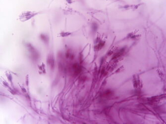 Blue-green Penicillium mold, the type of fungus that gave the world penicillin