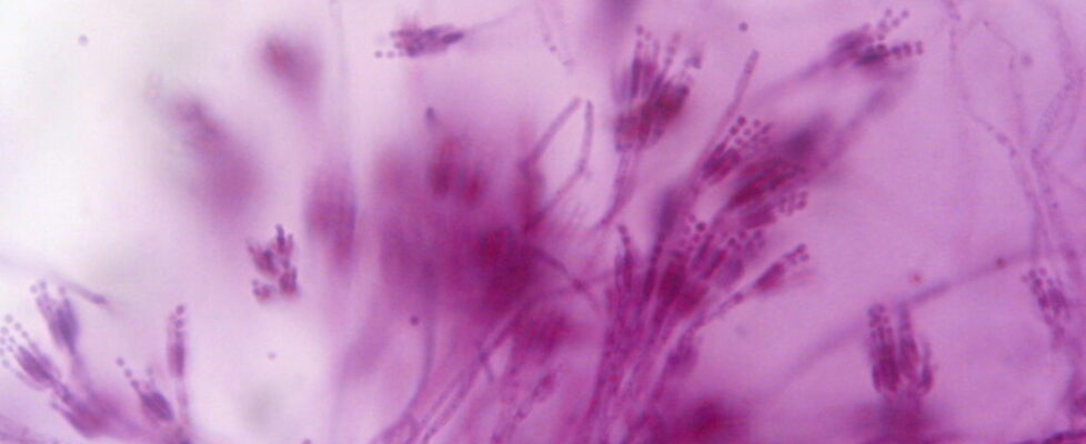 Blue-green Penicillium mold, the type of fungus that gave the world penicillin