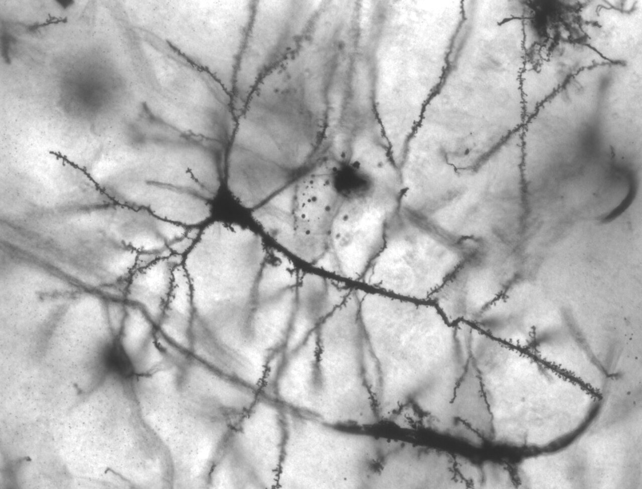 A stained pyramidal neuron from the hippocampus with its branching dendrites, seen under a microscope