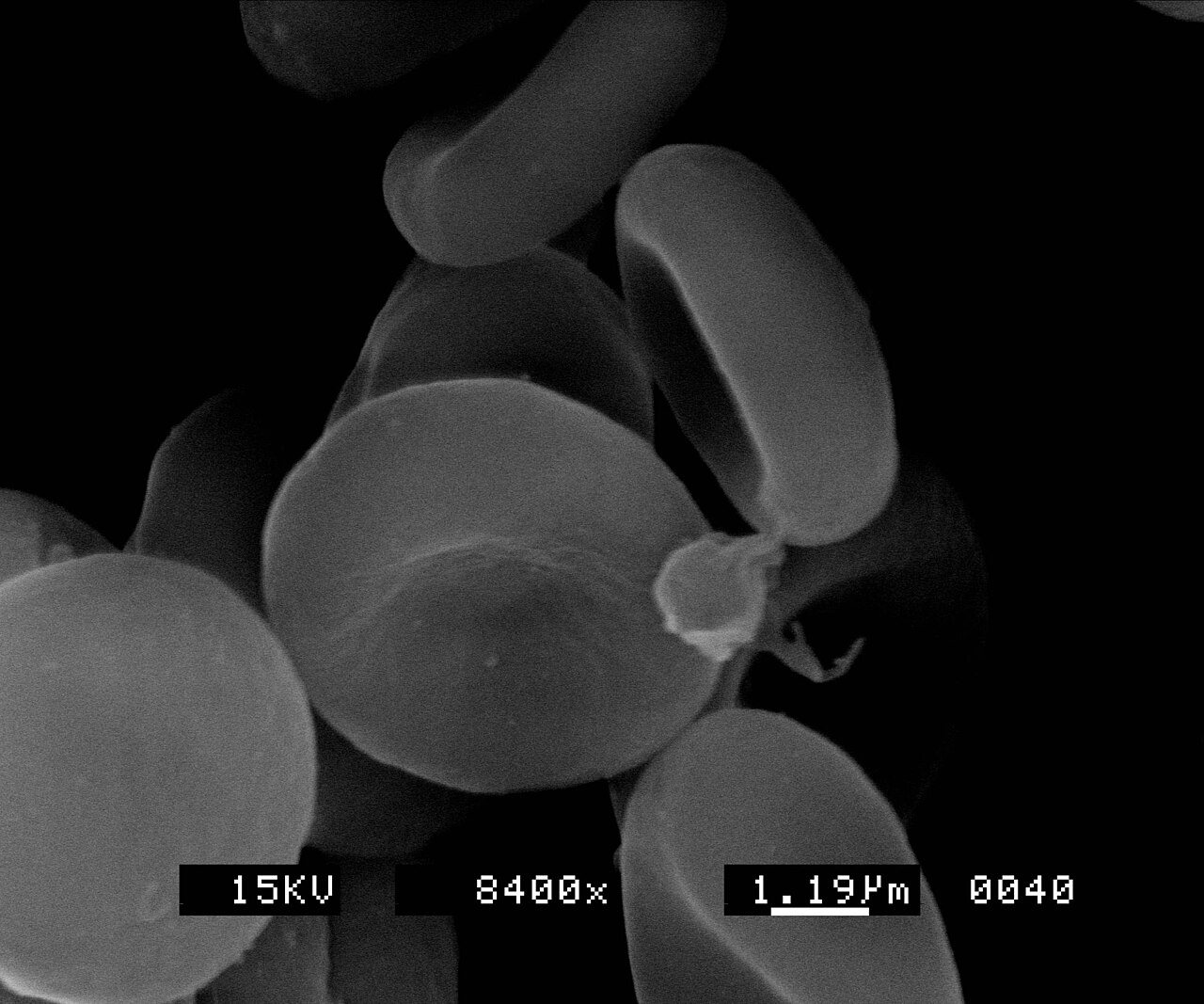 Red blood cells seen under a scanning electron microscope, shaped like smooth dimpled discs